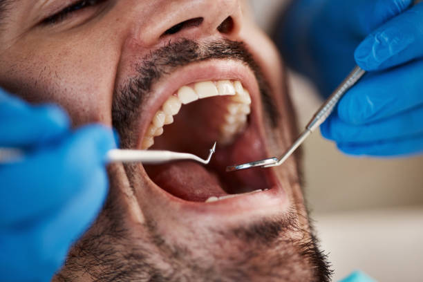 Best Same-Day Dentist Appointment  in Fruitdale, CA